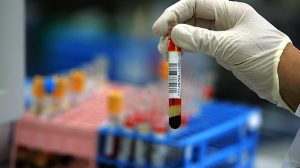sangue infetto